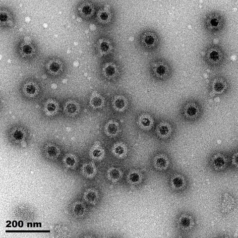 Electron micrograph of African Horse Sickness virus-like particles, which mimic the structure of the virus without causing sickness.